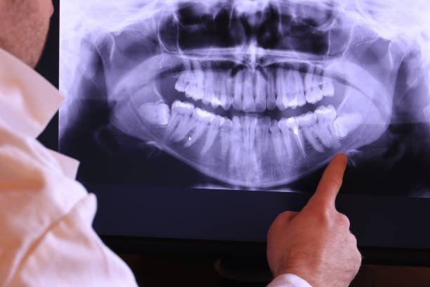 Best Pediatric Emergency Dentist in Valle Vista, CA