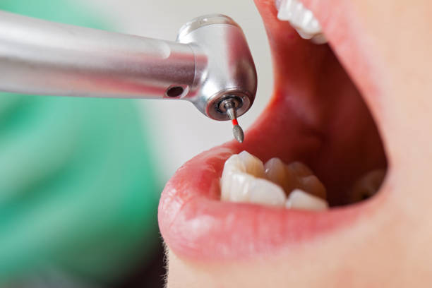 Best Same-Day Emergency Dental Services in Valle Vista, CA